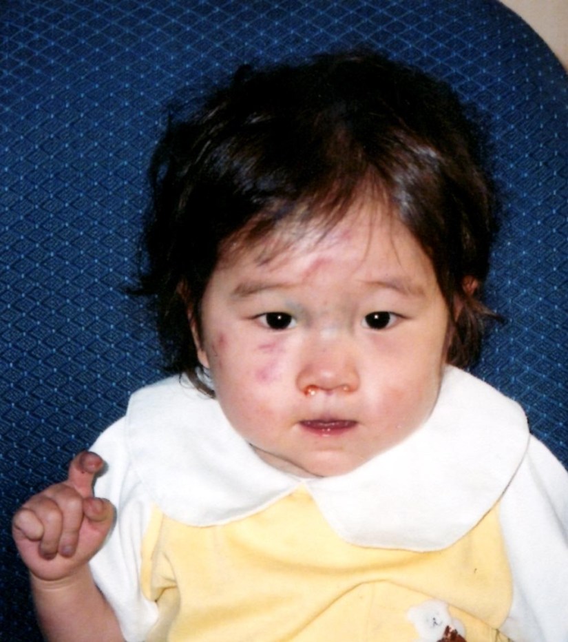 Sweet Marie- who was born with a serious heart defect. 2004